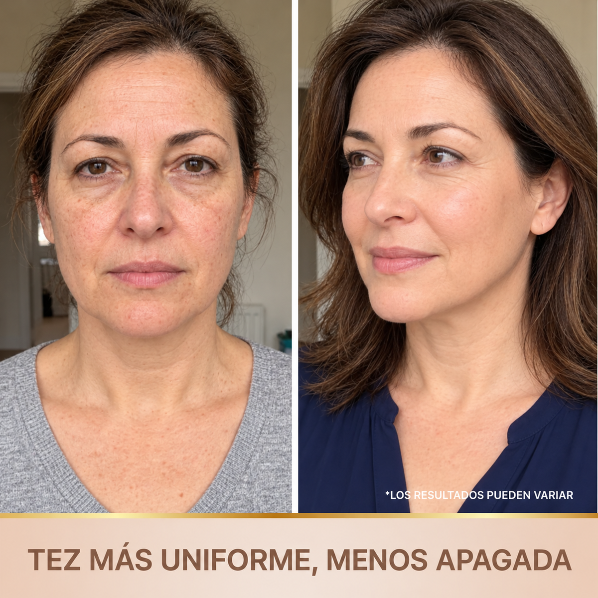 Monoe – Sérum Coreano con Efecto Lifting desde la Primera Aplicación